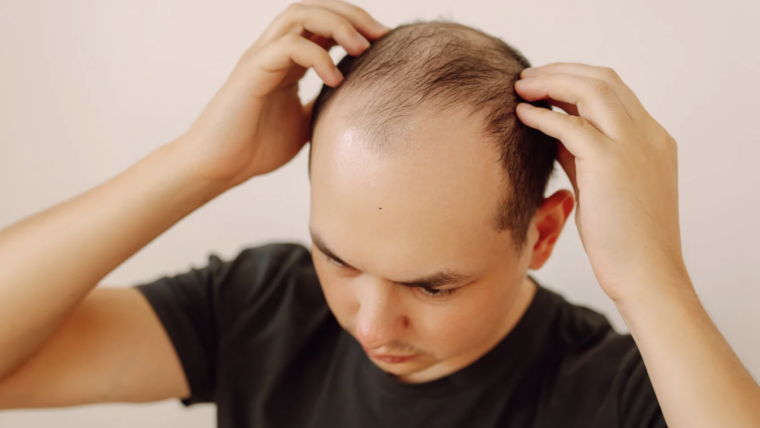 Hair Loss Specialist Appointment in Baltimore, Maryland